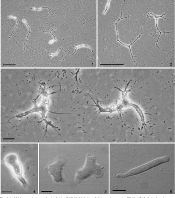  Género _Gephyramoeba_ ¿Un Amoebozoa con un estilo de vida realmente único?