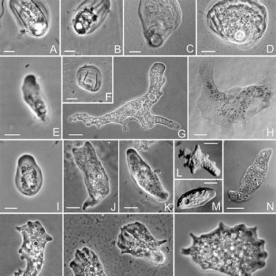  Niveolent: Un Viaje Microscópico a Través de los Amoebozoa con un Sentido Único del Estilo