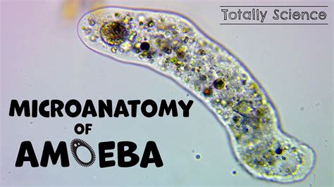  Taxamoeba! Un pequeño gigante del mundo microscópico que desafía las reglas de la vida