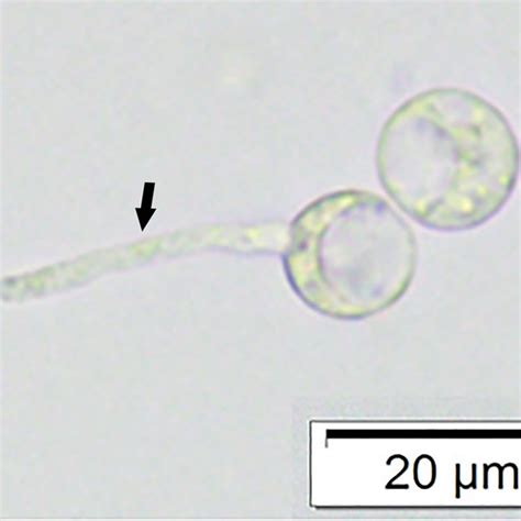 Zoosporangium! Unveiling the Enigmatic World of Free-Swimming Spores Within Unicellular Organisms