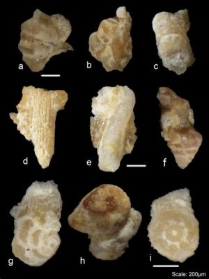  Foraminifera: Un Animalcule Escondito Que Construye Castillos Submarinos de Cal!