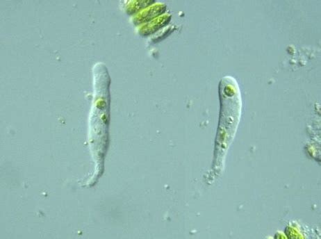  Hartmannella! Un Protista Inconspicuo que Desafía las Normas de la Vida