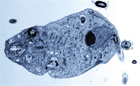  Monocercomonoides! Un Protozoo Curioso Que Carece de Mitocondrias