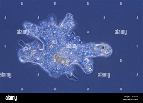 ¿Conoces al Rhizopoda? ¡Un microorganismo que conquista sus presas con pseudópodos expandibles!